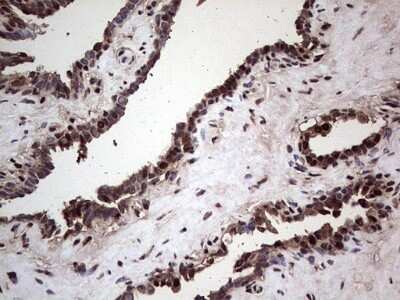 Immunohistochemistry: SUMO Activating Enzyme E1 (SAE1) Antibody (OTI6B11) - Azide and BSA Free [NBP2-74410]