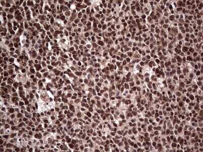 Immunohistochemistry: SUMO Activating Enzyme E1 (SAE1) Antibody (OTI6B11) - Azide and BSA Free [NBP2-74410]