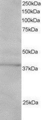 Western Blot: SUMO Activating Enzyme E1 (SAE1) Antibody [NB100-1312]