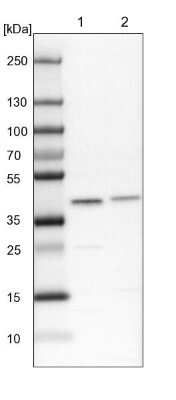 Western Blot: SUMO Activating Enzyme E1 (SAE1) Antibody [NBP2-13272]
