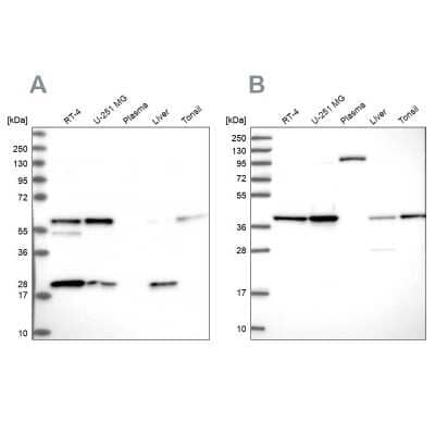 Western Blot: SUMO Activating Enzyme E1 (SAE1) Antibody [NBP2-13272]