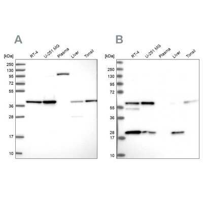 Western Blot: SUMO Activating Enzyme E1 (SAE1) Antibody [NBP2-13273]