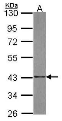 Western Blot: SUMO Activating Enzyme E1 (SAE1) Antibody [NBP2-20251]