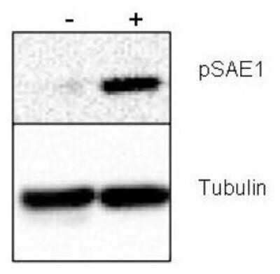 Western Blot: SUMO Activating Enzyme E1 (SAE1) [p Ser185] Antibody [NBP1-78069]