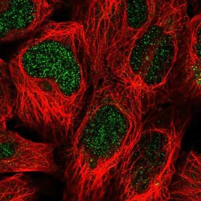 Immunocytochemistry/ Immunofluorescence: SUMO-interacting Motif (SIM) Antibody [NBP2-30700]