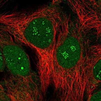 Immunocytochemistry/ Immunofluorescence: SUMO-interacting Motif (SIM) Antibody [NBP2-55180]