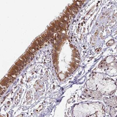 Immunohistochemistry-Paraffin: SUMO-interacting Motif (SIM) Antibody [NBP2-55180]