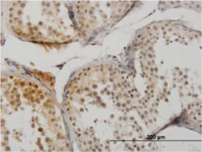 Immunohistochemistry-Paraffin: SUMO1 Antibody (3D7) [H00007341-M03]