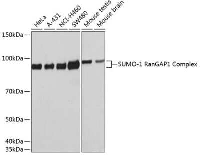 Western Blot: SUMO1 Antibody (6F8B6) [NBP3-15676]