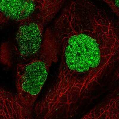 Immunocytochemistry/ Immunofluorescence: SUMO1 Antibody [NBP2-54916]