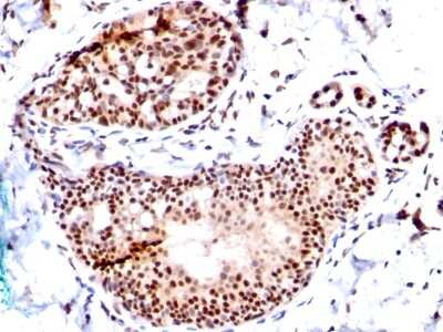 Immunohistochemistry-Paraffin: SUMO1 Antibody (SM1/495) - Azide and BSA Free [NBP2-34716]