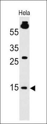 Western Blot: SUMO1 Antibody (SM1/495)Azide and BSA Free [NBP2-34716]