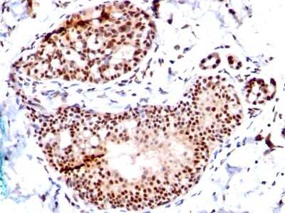Immunohistochemistry-Paraffin: SUMO1 Antibody (SM1/495) [NBP2-32901]