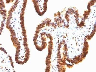 Immunohistochemistry-Paraffin: SUMO1 Antibody (SPM571) - Azide and BSA Free [NBP2-34805]