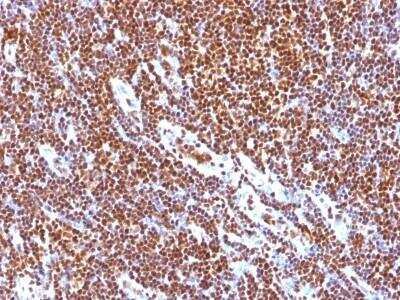 Immunohistochemistry-Paraffin: SUMO1 Antibody (SUMO1/1188) - Azide and BSA Free [NBP2-47697]