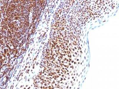 Immunohistochemistry-Paraffin: SUMO1 Antibody (SUMO1/1188) - Azide and BSA Free [NBP2-47697]