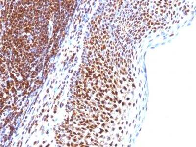 Immunohistochemistry-Paraffin: SUMO1 Antibody (SUMO1/1188) - IHC-Prediluted [NBP2-48449]