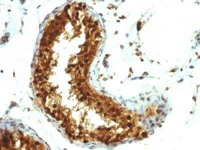 Immunohistochemistry-Paraffin: SUMO1 Antibody (SUMO1/1188) - IHC-Prediluted [NBP2-48449]