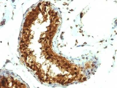 Immunohistochemistry-Paraffin: SUMO1 Antibody (SUMO1/1188) [NBP2-44460]