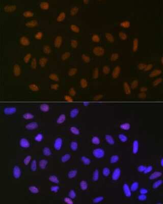 Immunocytochemistry/ Immunofluorescence: SUMO2/3 Antibody (6R8G7) [NBP3-16540]