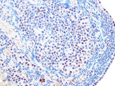 Immunohistochemistry-Paraffin: SUMO2/3 Antibody (6R8G7) [NBP3-16540]