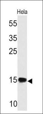 Western Blot: SUMO2/3 Antibody (SM23/496)Azide and BSA Free [NBP2-34717]