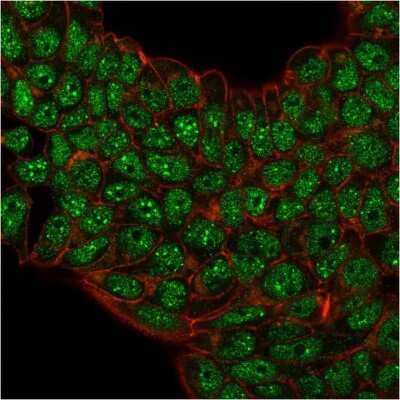 Immunocytochemistry/ Immunofluorescence: SUMO2/3 Antibody (SM23/496) [NBP2-34292]