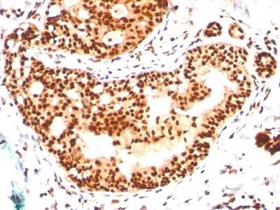 Immunohistochemistry-Paraffin: SUMO2/3 Antibody (SM23/496) [NBP2-34292]