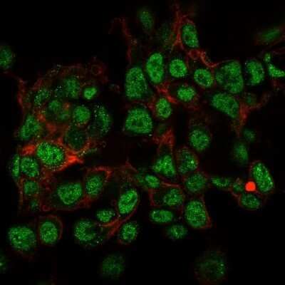 Immunocytochemistry/ Immunofluorescence: SUMO2/3 Antibody (SPM572) - Azide and BSA Free [NBP2-34431]