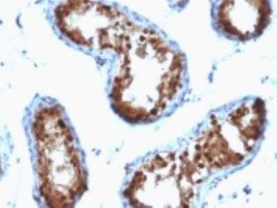 Immunohistochemistry-Paraffin: SUMO2/3 Antibody (SPM572) - IHC-Prediluted [NBP2-45336]