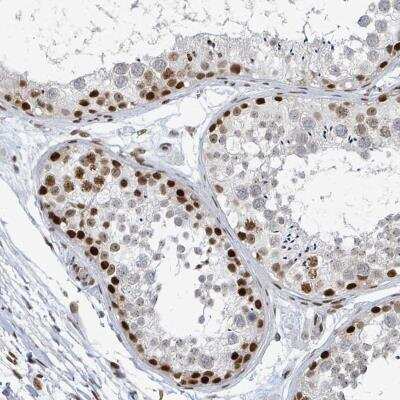 Immunohistochemistry: SUMO2 Antibody [NBP2-46758]
