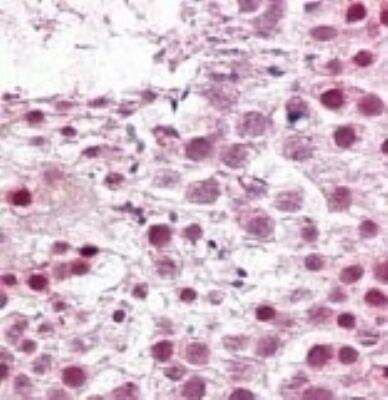 Immunohistochemistry-Paraffin: SUMO2 Antibody [NB100-56444]