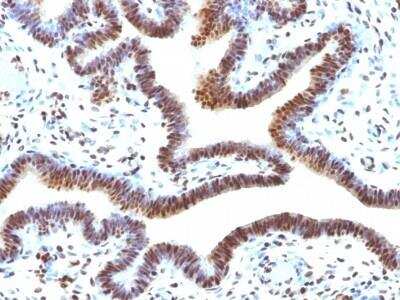 Immunohistochemistry-Paraffin: SUMO2 Antibody (SUMO2/1199) - Azide and BSA Free [NBP2-47710]