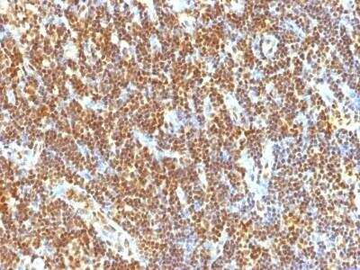 Immunohistochemistry-Paraffin: SUMO2 Antibody (SUMO2/1199) - Azide and BSA Free [NBP2-47710]
