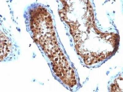 Immunohistochemistry-Paraffin: SUMO2 Antibody (SUMO2/1199) - Azide and BSA Free [NBP2-47710]