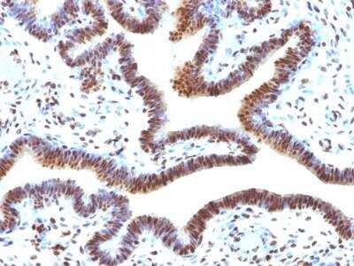 Immunohistochemistry-Paraffin: SUMO2 Antibody (SUMO2/1199) - IHC-Prediluted [NBP2-48454]