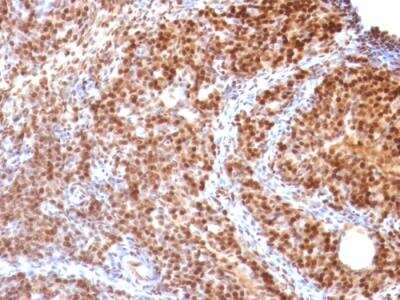 Immunohistochemistry-Paraffin: SUMO2 Antibody (SUMO2/1199) - IHC-Prediluted [NBP2-48454]