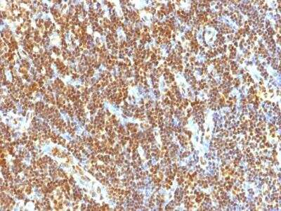 Immunohistochemistry-Paraffin: SUMO2 Antibody (SUMO2/1199) - IHC-Prediluted [NBP2-48454]