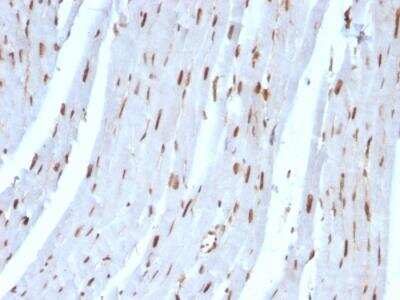 Immunohistochemistry-Paraffin: SUMO2 Antibody (SUMO2/1199) - IHC-Prediluted [NBP2-48454]