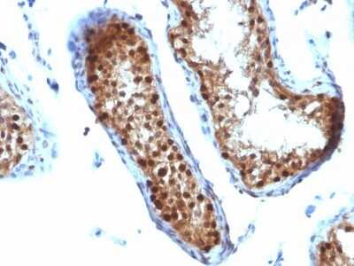 Immunohistochemistry-Paraffin: SUMO2 Antibody (SUMO2/1199) [NBP2-44477]