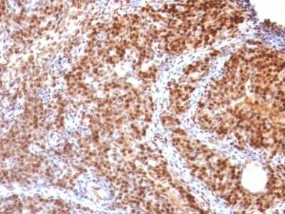 Immunohistochemistry-Paraffin: SUMO2 Antibody (SUMO2/1199) [NBP2-44477]