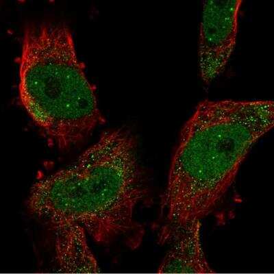 Immunocytochemistry/ Immunofluorescence: SUMO4 Antibody [NBP2-34073]