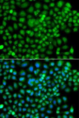 Immunocytochemistry/ Immunofluorescence: SUMO4 Antibody - BSA Free [NBP2-93213]
