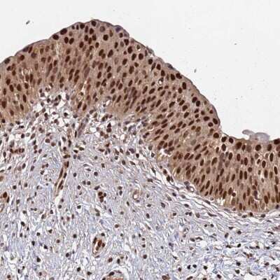 Immunohistochemistry-Paraffin: SUMO4 Antibody [NBP2-34073]