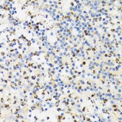 Immunohistochemistry-Paraffin: SUMO4 Antibody - BSA Free [NBP2-95198]