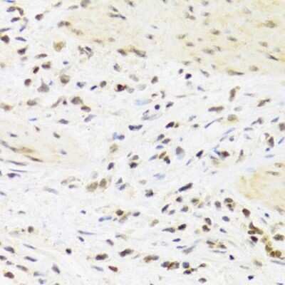Immunohistochemistry-Paraffin: SUMO4 Antibody - BSA Free [NBP2-95198]