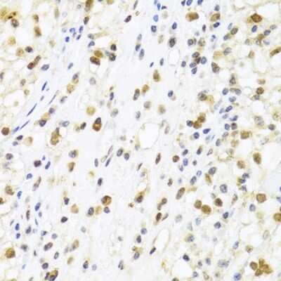 Immunohistochemistry-Paraffin: SUMO4 Antibody - BSA Free [NBP2-95198]