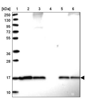 Western Blot: SUMO4 Antibody [NBP2-34073]