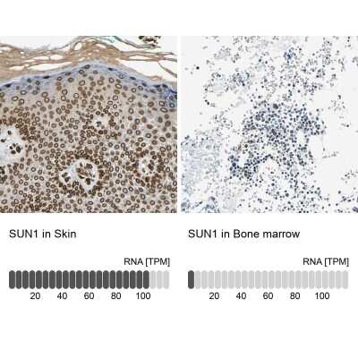 Immunohistochemistry-Paraffin: SUN1 Antibody [NBP1-87395]