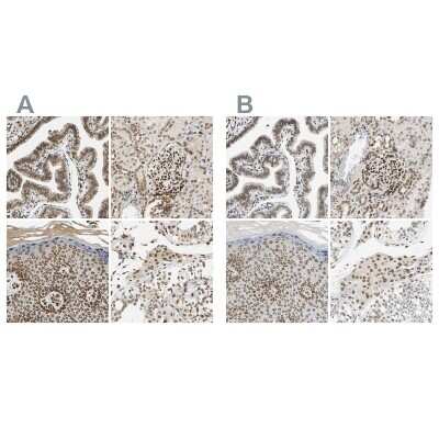 Immunohistochemistry-Paraffin: SUN1 Antibody [NBP1-87395]